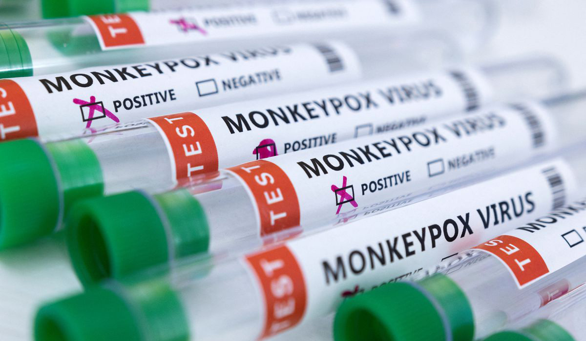 Monkeypox virus